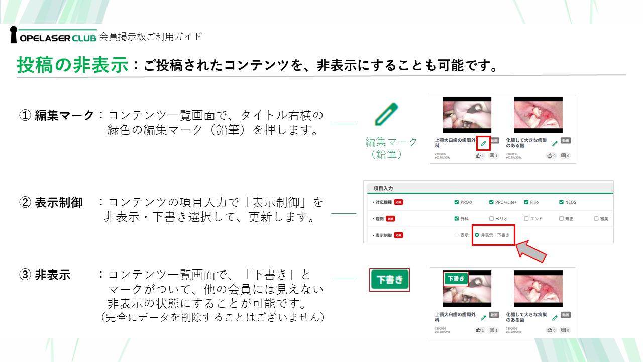 オペレーザークラブ：会員掲示板・非表示にする
