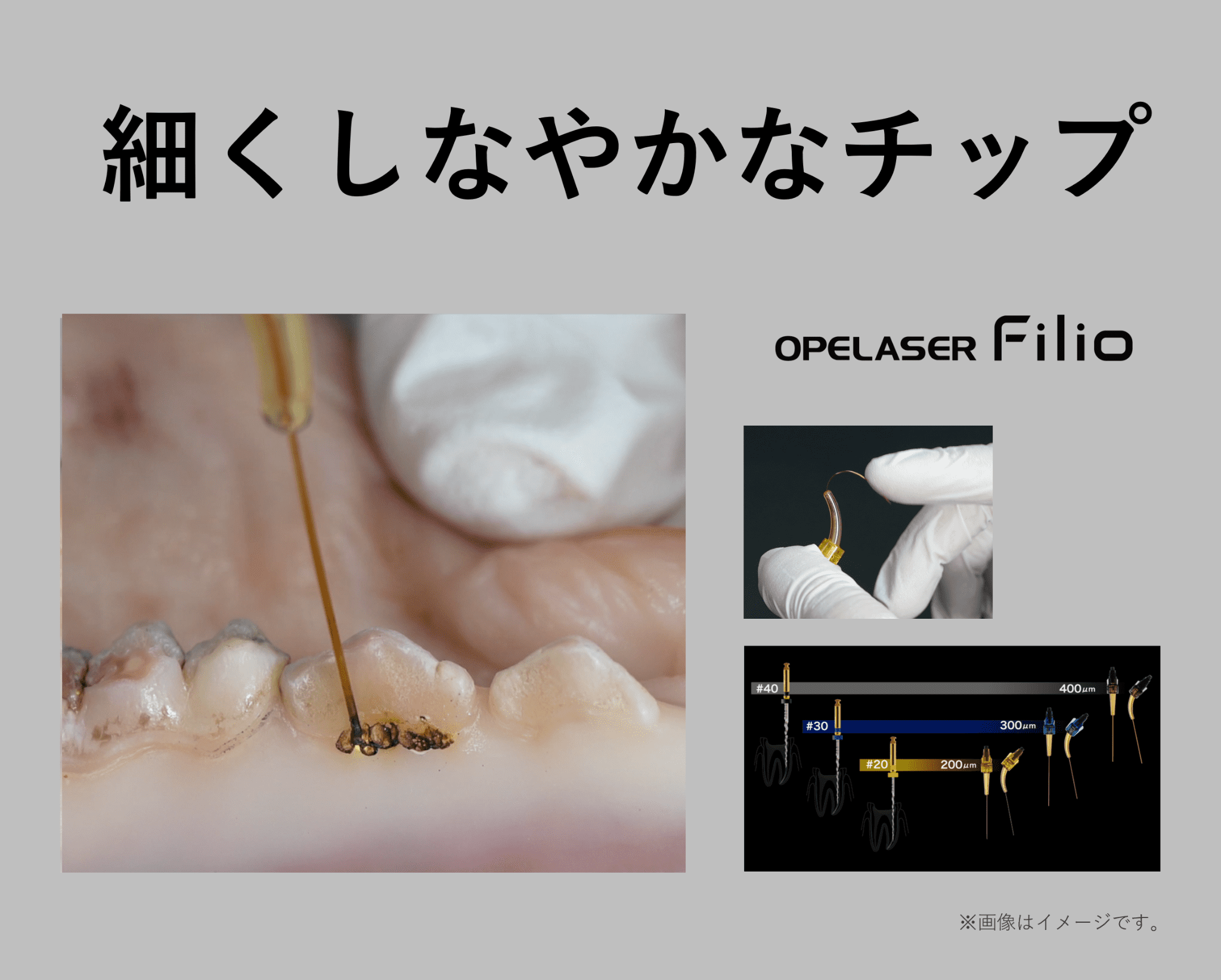 ファイバーチップ