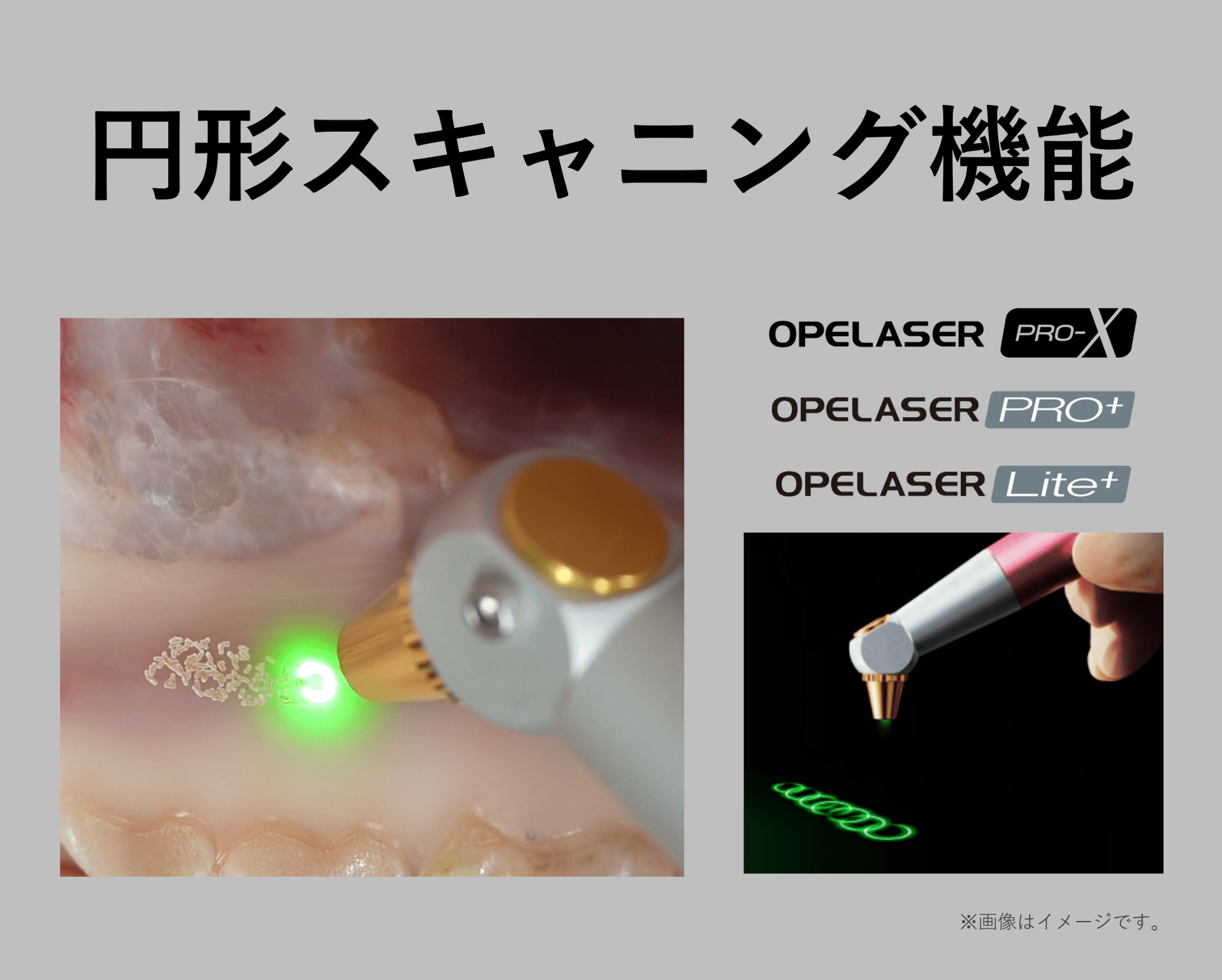 円形スキャニング